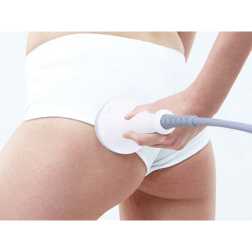 セルチューン 本体/備品